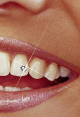 Fogékszer, fogékszerek, Swarovski-kristály. www.pannoniadental.hu